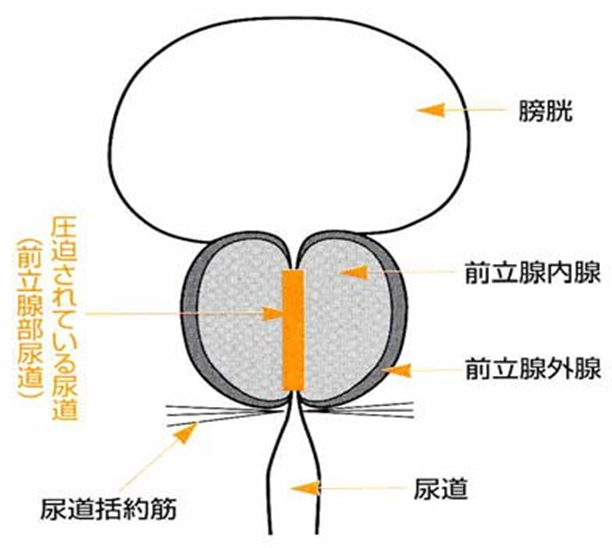圧迫されている尿道