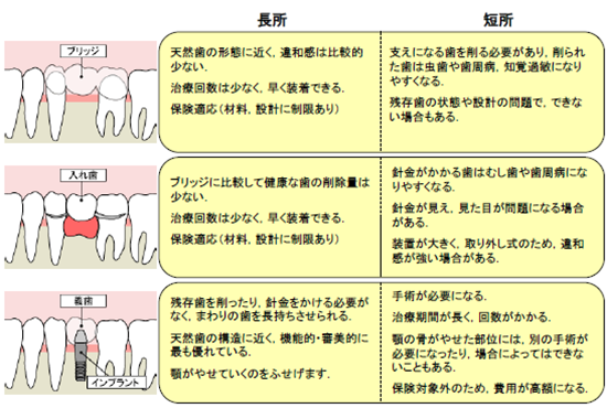 歯を失った時の治療法